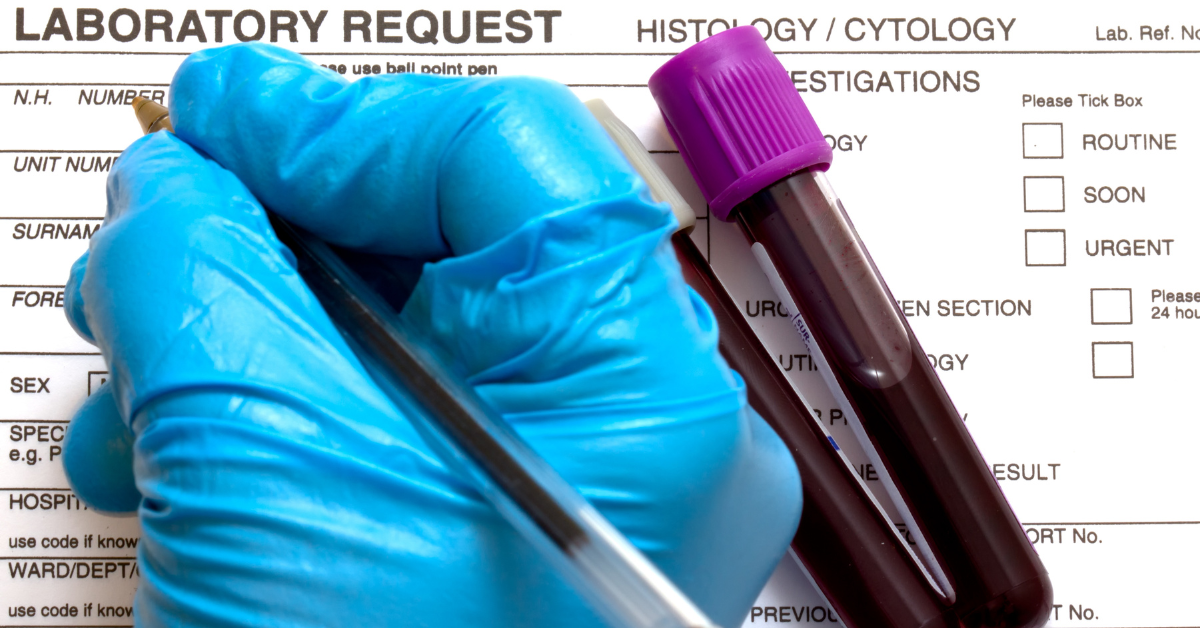 Laboratory technician writing barcode on sample tubes for laboratory sample tracking