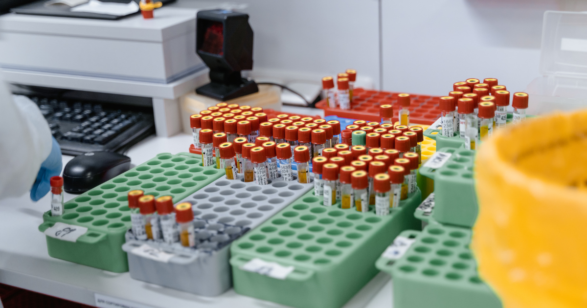 Laboratory sample tubes at reception desk with barcode scanner, illustrating sample management and turnaround time in a clinical lab