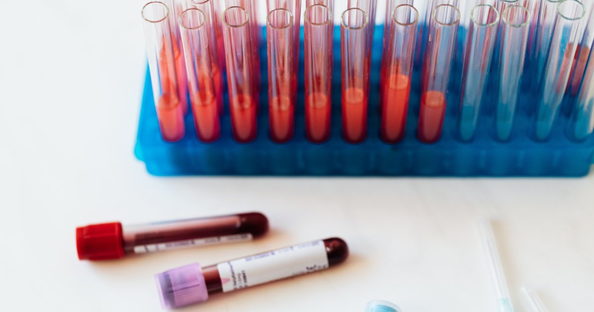 Laboratory technician handling blood collection tubes to prevent hemolysis in the pre-analytical phase